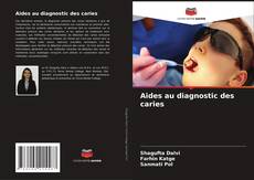 Buchcover von Aides au diagnostic des caries