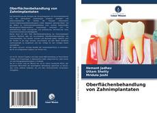 Buchcover von Oberflächenbehandlung von Zahnimplantaten