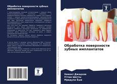 Обложка Обработка поверхности зубных имплантатов