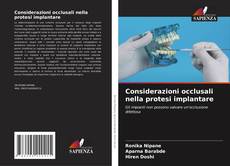 Copertina di Considerazioni occlusali nella protesi implantare