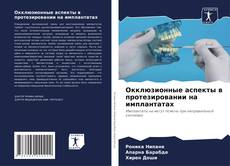 Bookcover of Окклюзионные аспекты в протезировании на имплантатах