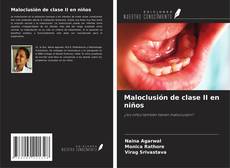 Couverture de Maloclusión de clase II en niños