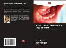 Borítókép a  Malocclusion de classe II chez l'enfant - hoz