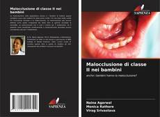 Copertina di Malocclusione di classe II nei bambini
