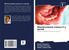 Обложка Малокклюзия класса II у детей