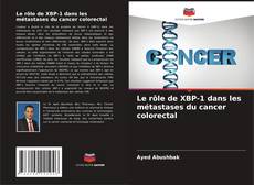 Copertina di Le rôle de XBP-1 dans les métastases du cancer colorectal