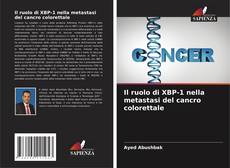 Обложка Il ruolo di XBP-1 nella metastasi del cancro colorettale