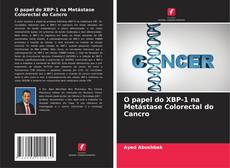 Buchcover von O papel do XBP-1 na Metástase Colorectal do Cancro