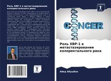 Bookcover of Роль XBP-1 в метастазировании колоректального рака