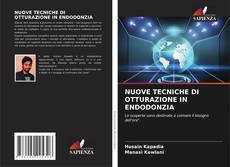 Buchcover von NUOVE TECNICHE DI OTTURAZIONE IN ENDODONZIA
