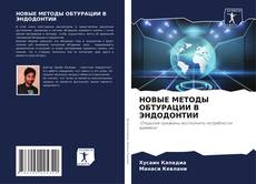 Buchcover von НОВЫЕ МЕТОДЫ ОБТУРАЦИИ В ЭНДОДОНТИИ