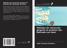 Métodos de retracción gingival en prótesis fija. Retirada con láser kitap kapağı