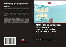 Couverture de Méthodes de rétraction gingivale en prosthodontie fixe. Rétraction au laser