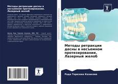 Bookcover of Методы ретракции десны в несъемном протезировании. Лазерный желоб
