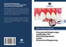 Kronenverlängerungs- methoden für Weichteilgewebe. Laser-Kronenverlängerung kitap kapağı