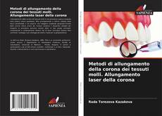 Couverture de Metodi di allungamento della corona dei tessuti molli. Allungamento laser della corona