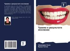 Copertina di Травма в результате окклюзии