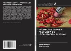 Couverture de TROMBOSIS VENOSA PROFUNDA DE LOCALIZACIÓN INUSUAL