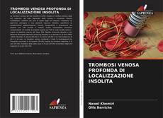 Couverture de TROMBOSI VENOSA PROFONDA DI LOCALIZZAZIONE INSOLITA