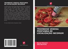 TROMBOSE VENOSA PROFUNDA DE LOCALIZAÇÃO INCOMUM kitap kapağı