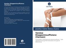 Copertina di Venöse Klappeninsuffizienz (Varizen)