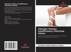 Valvular Venous Insufficiency (Varicose Veins)的封面