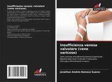 Couverture de Insufficienza venosa valvolare (vene varicose)