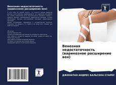Bookcover of Венозная недостаточность (варикозное расширение вен)