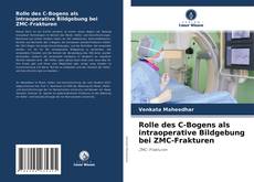 Rolle des C-Bogens als intraoperative Bildgebung bei ZMC-Frakturen kitap kapağı
