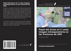 Buchcover von Papel del brazo en C como imagen intraoperatoria en las fracturas de ZMC