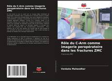 Couverture de Rôle du C-Arm comme imagerie peropératoire dans les fractures ZMC