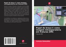 Buchcover von Papel do braço C como imagem intraoperatória em fraturas ZMC