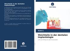 Portada del libro de Weichteile in der dentalen Implantologie
