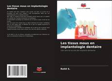 Borítókép a  Les tissus mous en implantologie dentaire - hoz