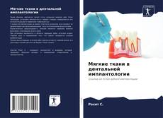 Bookcover of Мягкие ткани в дентальной имплантологии