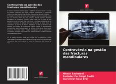 Couverture de Controvérsia na gestão das fracturas mandibulares