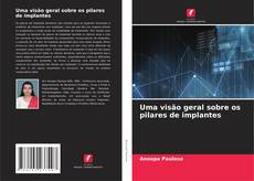 Bookcover of Uma visão geral sobre os pilares de implantes