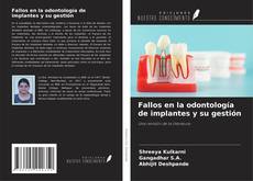 Fallos en la odontología de implantes y su gestión的封面