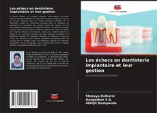 Borítókép a  Les échecs en dentisterie implantaire et leur gestion - hoz