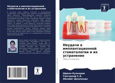 Buchcover von Неудачи в имплантационной стоматологии и их устранение