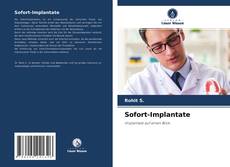 Copertina di Sofort-Implantate