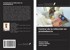 Copertina di Control de la infección en prostodoncia