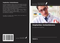 Buchcover von Implantes instantáneos