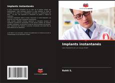 Borítókép a  Implants instantanés - hoz
