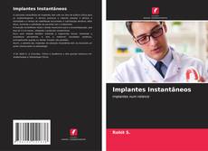 Buchcover von Implantes Instantâneos