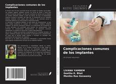 Buchcover von Complicaciones comunes de los implantes