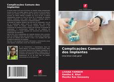 Copertina di Complicações Comuns dos Implantes