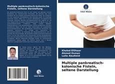 Copertina di Multiple pankreatisch-kolonische Fisteln, seltene Darstellung