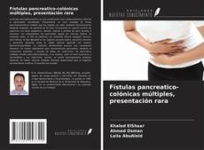 Copertina di Fístulas pancreatico-colónicas múltiples, presentación rara