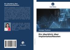 Copertina di Ein überblick über implantataufbauten